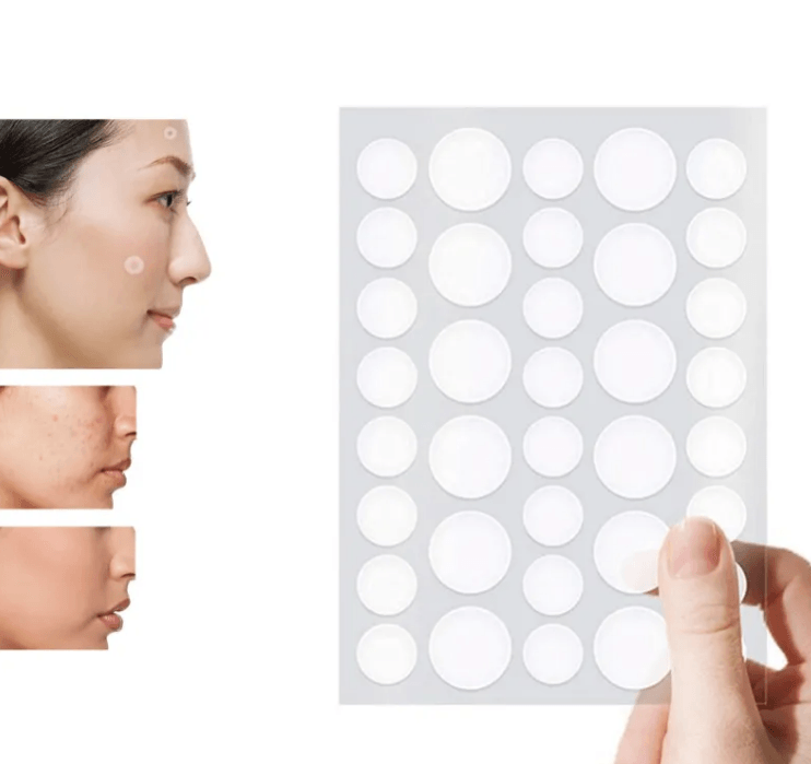 Clear skin with acne patches
