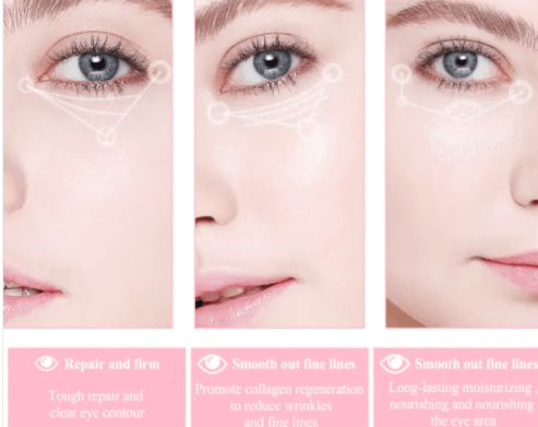Under-eye skin treatment for fine lines